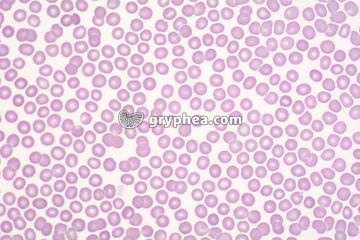 Hématies (globules rouges) x200 - gryphea.org